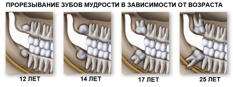 Сколько зубов у человека - стоматология Блеск в Новосибирске