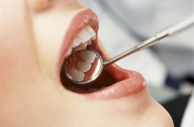 Народные средства от зубной боли