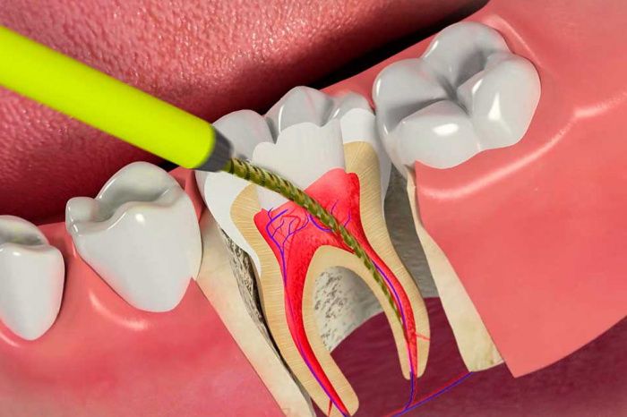 Основные причины зубной боли