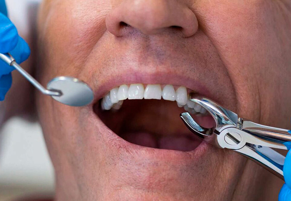 Зуб после лечения пульпита